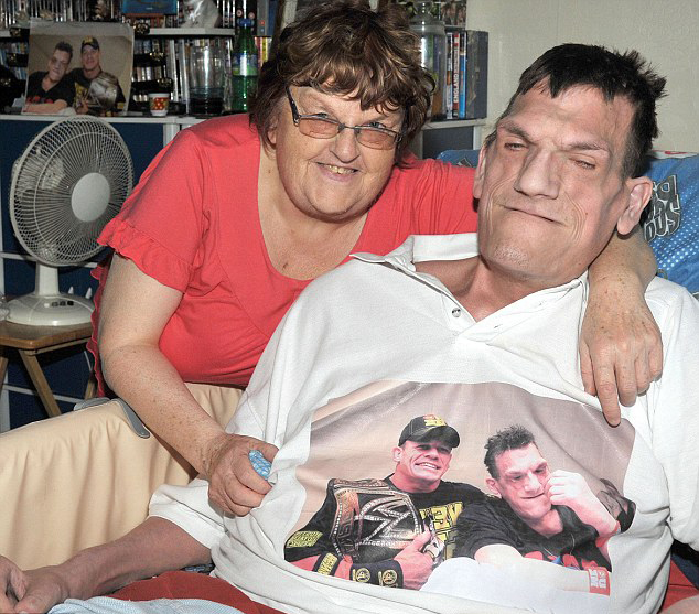 英&ldquo;巨人癥&rdquo;男子高超2米仍在長