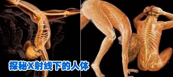 人體的神奇 探秘X射線(xiàn)下的人體